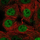 Anti-SIVA1 Antibody