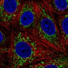 Immunofluorescent staining of human cell line MCF7 shows localization to mitochondria.