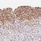 Anti-NFE2L1 Antibody