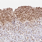 Anti-NFE2L1 Antibody
