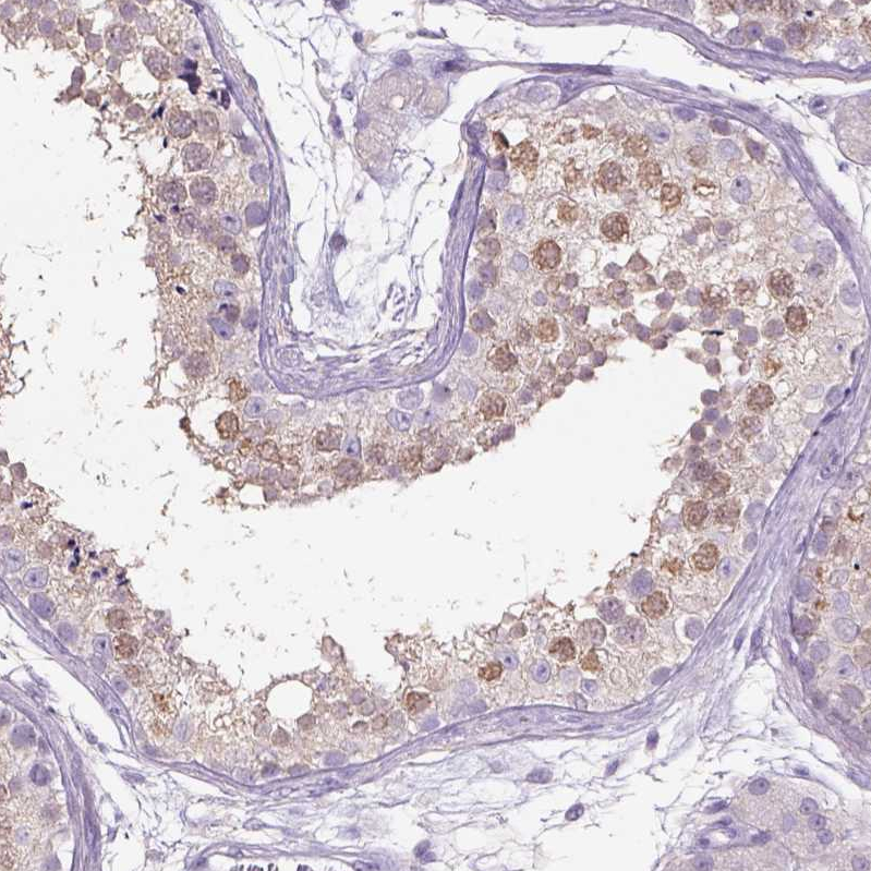 Anti-NAALAD2 Antibody