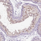 Anti-NAALAD2 Antibody