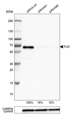 Western blot analysis in U-251MG cells transfected with control siRNA, target specific siRNA probe #1 and #2, using Anti-FUS antibody. Remaining relative intensity is presented. Loading control: Anti-GAPDH.