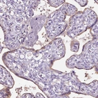 Immunohistochemical staining of human placenta shows moderate cytoplasmic positivity in trophoblastic cells.
