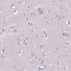 Immunohistochemical staining of human cerebral cortex shows moderate cytoplasmic positivity in neurons.