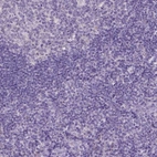 Immunohistochemical staining of human tonsil shows no positivity in non-germinal center cells as expected.
