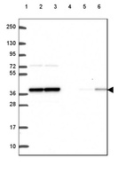Lane 1: Marker [kDa] 250, 130, 95, 72, 55, 36, 28, 17, 10_br/_Lane 2: Human cell line RT-4_br/_Lane 3: Human cell line U-251 MG_br/_Lane 4: Human plasma_br/_Lane 5: Human Liver tissue_br/_Lane 6: Human Tonsil tissue