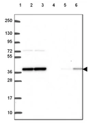 Lane 1: Marker [kDa] 250, 130, 95, 72, 55, 36, 28, 17, 10_br/_Lane 2: Human cell line RT-4_br/_Lane 3: Human cell line U-251 MG_br/_Lane 4: Human plasma_br/_Lane 5: Human Liver tissue_br/_Lane 6: Human Tonsil tissue