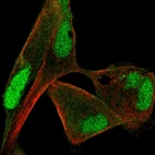 Immunofluorescent staining of human cell line RH-30 shows localization to nucleus & plasma membrane.
