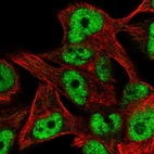 Anti-ZNF559 Antibody