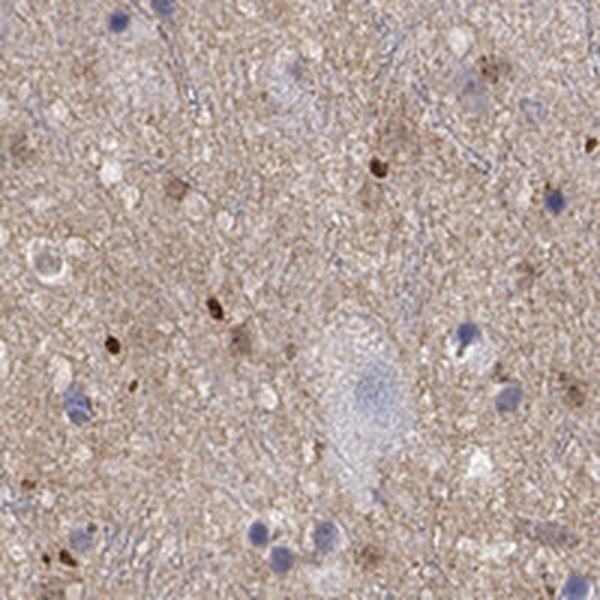 Anti-FGF2 Antibody