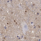Anti-FGF2 Antibody