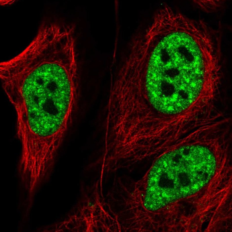 Anti-ZNF621 Antibody