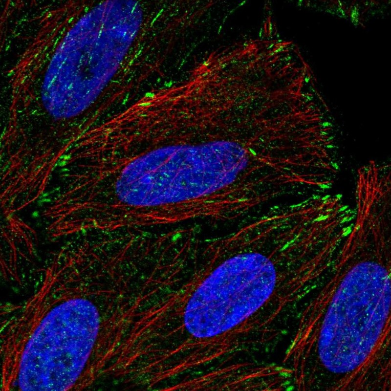 Anti-TM4SF20 Antibody