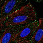 Anti-TM4SF20 Antibody