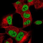 Immunofluorescent staining of human cell line SH-SY5Y shows localization to nucleoplasm.