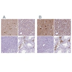 Immunohistochemical staining of human cerebral cortex, liver, pancreas and testis using Anti-APOE antibody HPA065539 (A) shows similar protein distribution across tissues to independent antibody HPA068768 (B).
