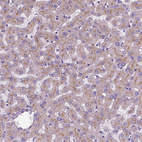 Immunohistochemical staining of human liver shows moderate cytoplasmic positivity in hepatocytes.