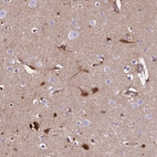 Immunohistochemical staining of human cerebral cortex shows strong cytoplasmic positivity in neurons.