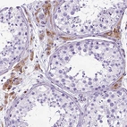 Immunohistochemical staining of human testis shows moderate cytoplasmic positivity in Leydig cells.