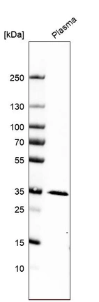 Western blot analysis in human plasma.