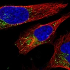 Immunofluorescent staining of human cell line U-2 OS shows localization to vesicles.