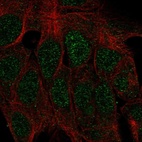 Anti-ATOH1 Antibody