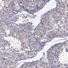 Anti-TEX22 Antibody