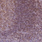 Anti-MKRN2OS Antibody