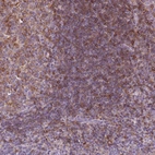 Anti-MKRN2OS Antibody