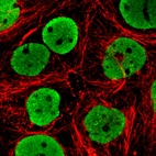Immunofluorescence staining in MCF7 cell line with Anti-FUS monoclonal antibody, showing clear nuclear (without nucleoli) staining in green. Microtubule- and nuclear probes are visualized in red and blue respectively (where available).