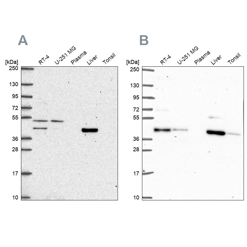 Anti-PHKG2 Antibody