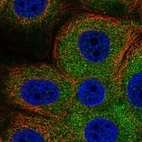 Immunofluorescent staining of human cell line MCF7 shows localization to cytosol.
