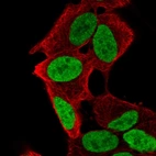 Anti-PHOX2A Antibody