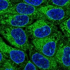 Immunofluorescent staining of human cell line RT4 shows localization to endoplasmic reticulum.
