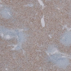 Anti-SLC40A1 Antibody