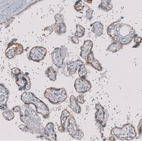 Immunohistochemical staining of human placenta shows moderate to strong positivity in basolateral membrane in trophoblastic cells.