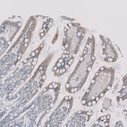 Immunohistochemical staining of human small intestine shows moderate membranous and cytoplasmic positivity in glandular cells.