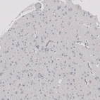 Immunohistochemical staining of human cerebral cortex shows no membranous positivity in neuronal cells as expected.
