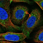Immunofluorescent staining of human cell line U-2 OS shows localization to plasma membrane & cytosol.