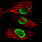 Anti-FUS Antibody