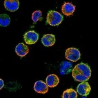 Immunofluorescent staining of human cell line HDLM-2 shows localization to plasma membrane & cytosol.