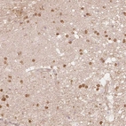 Anti-QDPR Antibody