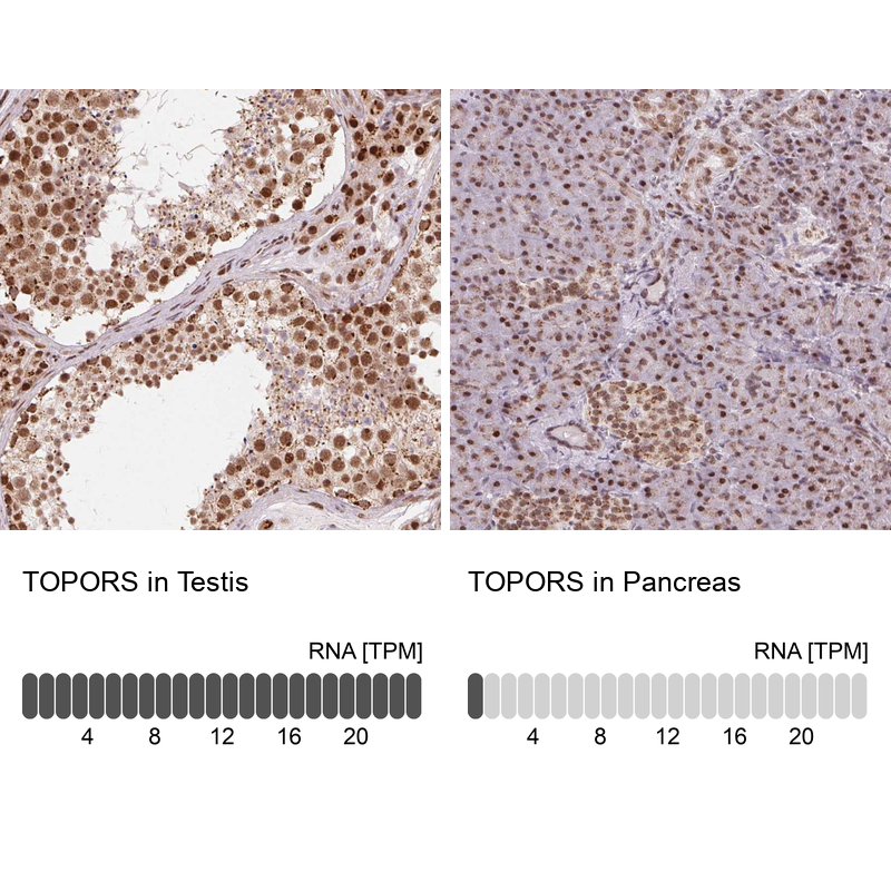 Anti-TOPORS Antibody