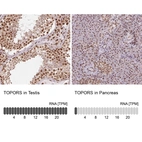 Anti-TOPORS Antibody