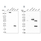 Western blot analysis using Anti-QDPR antibody HPA065649 (A) shows similar pattern to independent antibody HPA058951 (B).