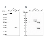 Western blot analysis using Anti-QDPR antibody HPA065649 (A) shows similar pattern to independent antibody HPA058951 (B).