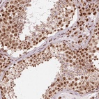 Immunohistochemical staining of human testis shows high expression.