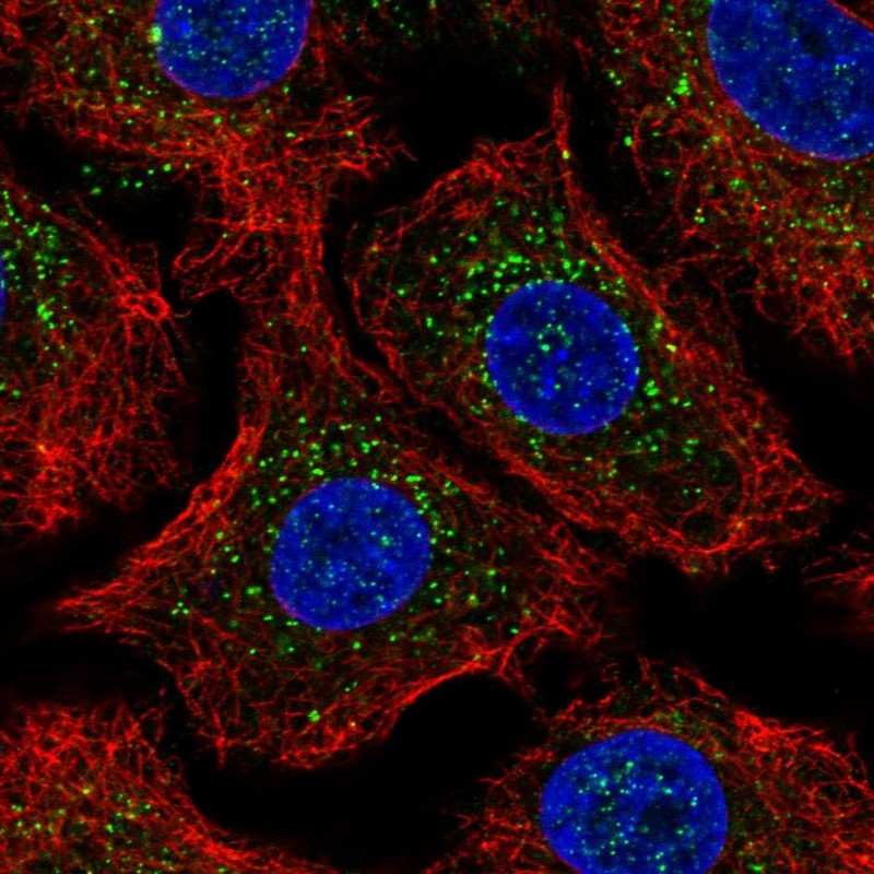Anti-ARRB2 Antibody