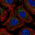 Anti-ARRB2 Antibody